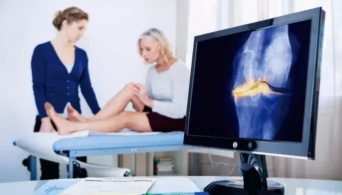 Artrosis da articulación nunha muller